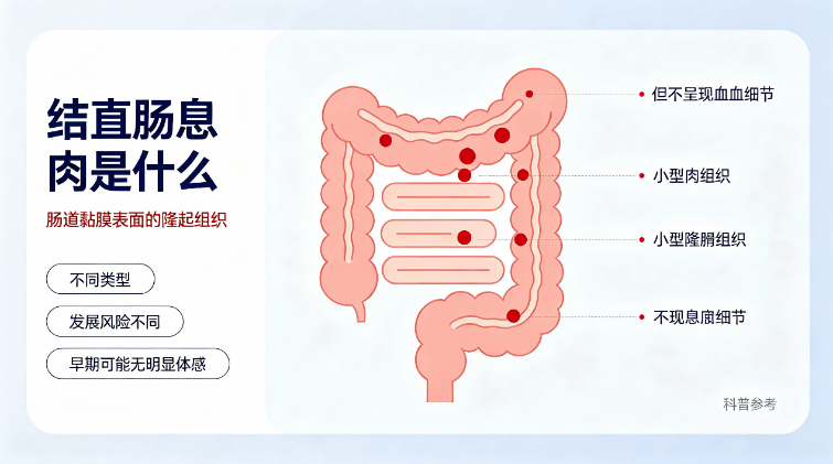 结直肠息肉，读懂这份客观认知